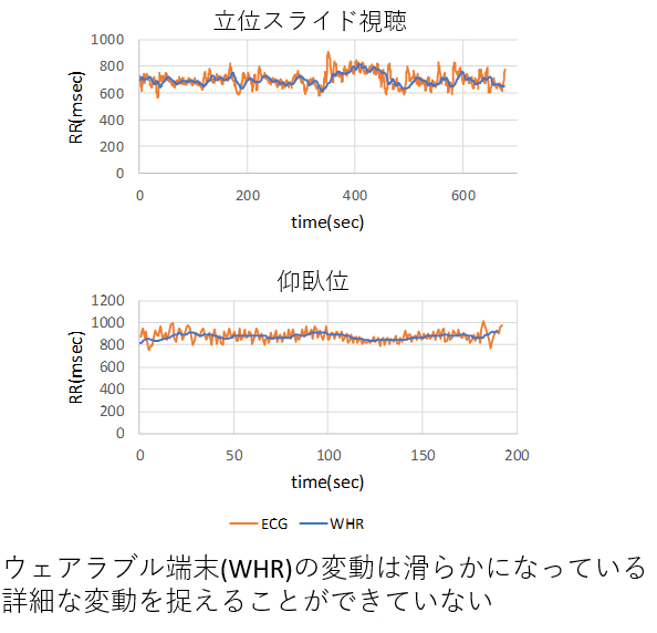 ウェアラブル端末の拍動間隔時系列と心電図の拍動間隔の比較